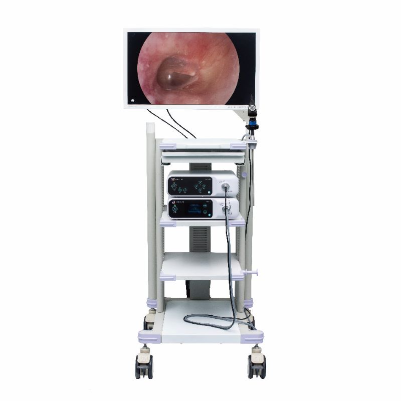 Full HD Endoscope Camera System Tower