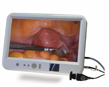 ALL IN ONE Endoscope Camera System