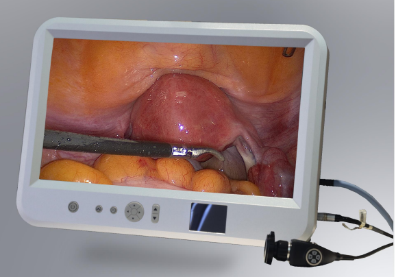 ALL IN ONE Endoscope Camera System